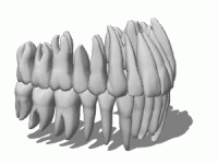 Tooth root resorption 3d model preview